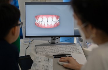 Ortodoncia invisible en Santiago de Chile